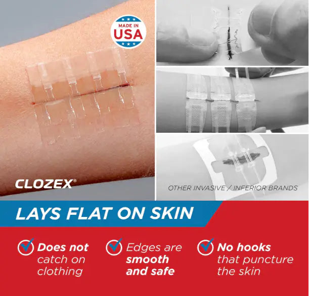 Emergency Laceration Closures