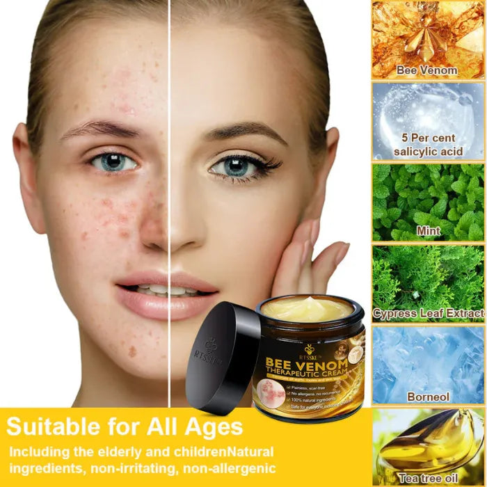 Zavinox Bee Venom Skin Treatment Cream